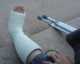 Poor Hang's foot